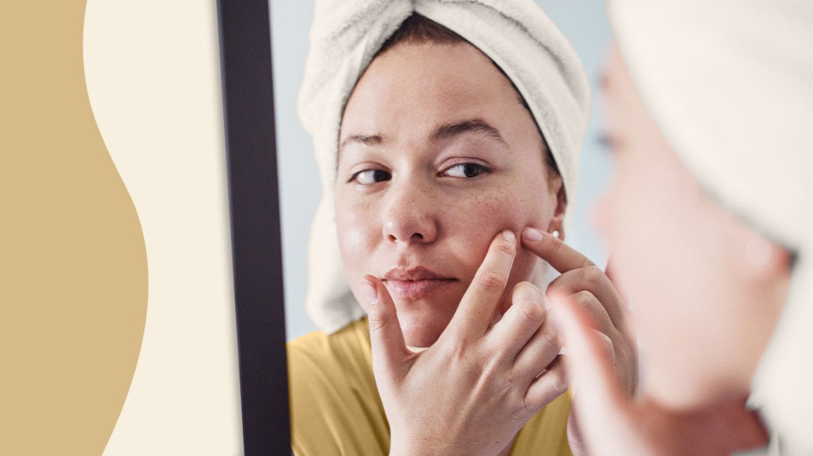 Acne Treatment for Adults