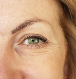FACIALS DO NOT TREAT WRINKLES