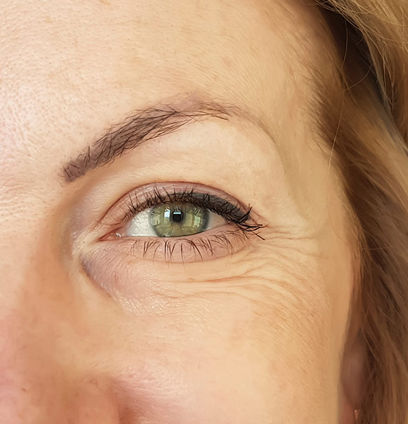 FACIALS DO NOT TREAT WRINKLES